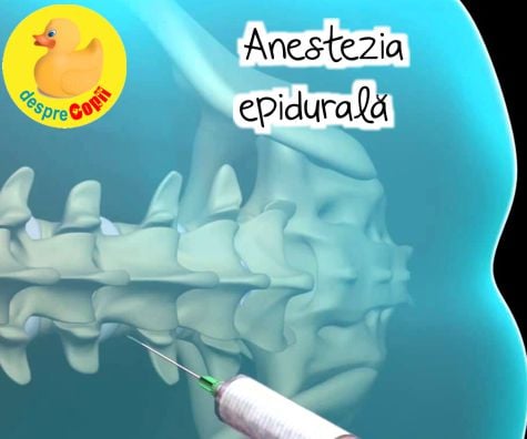 Anestezia epidurala -  tipuri si efecte in travaliu - tot ce trebuie sa stii in avans cu sfatul medicului