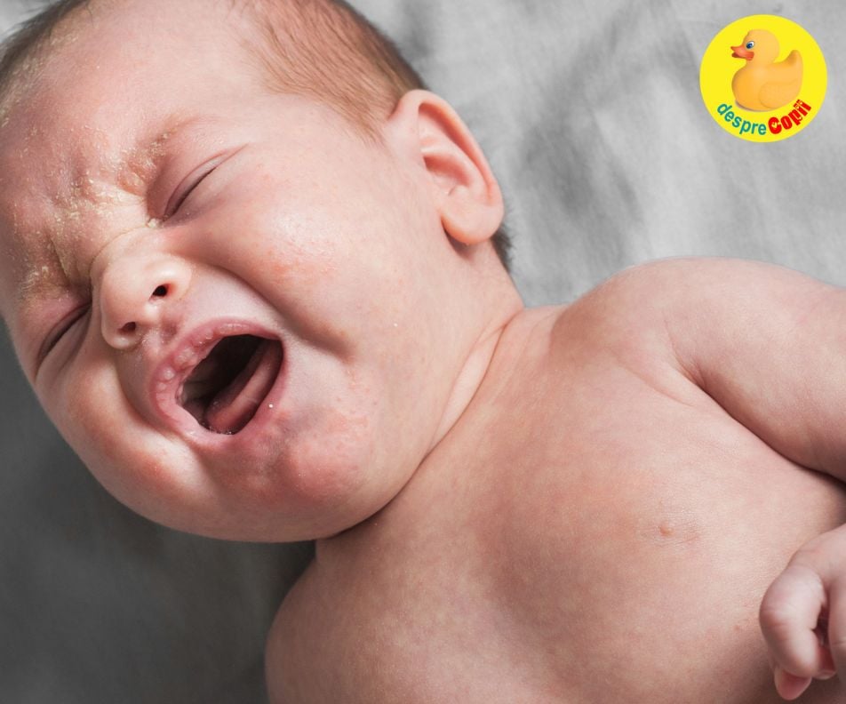 Bebelusii plangaciosi si cu probleme de somn ar putea avea un risc de ADHD si dificultati de reglare emotionala