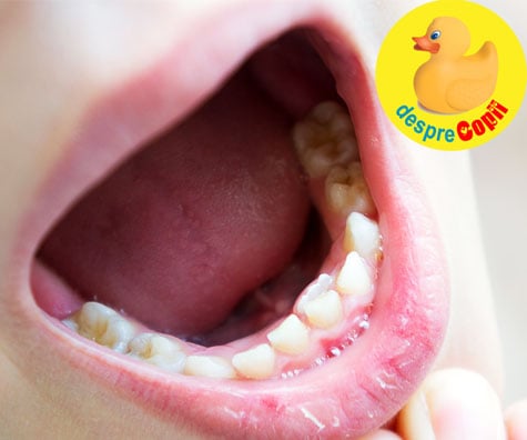 De ce apar dintii permanenti inainte ca dintii de lapte sa cada?