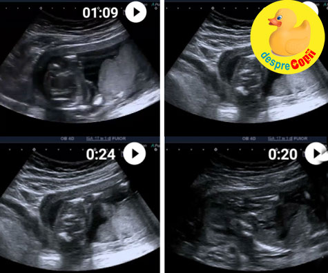Covid in sarcina -  primul control dupa boala - jurnal de sarcina