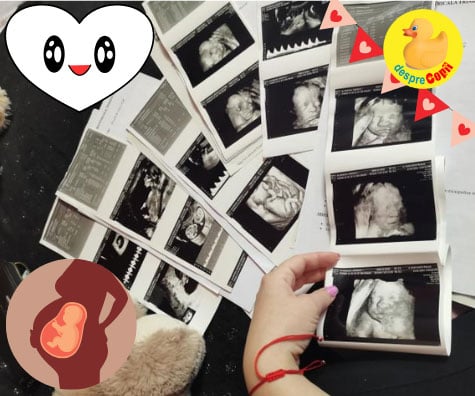 Ecografiile din sarcina -  primul album foto al bebelinei - jurnal de sarcina