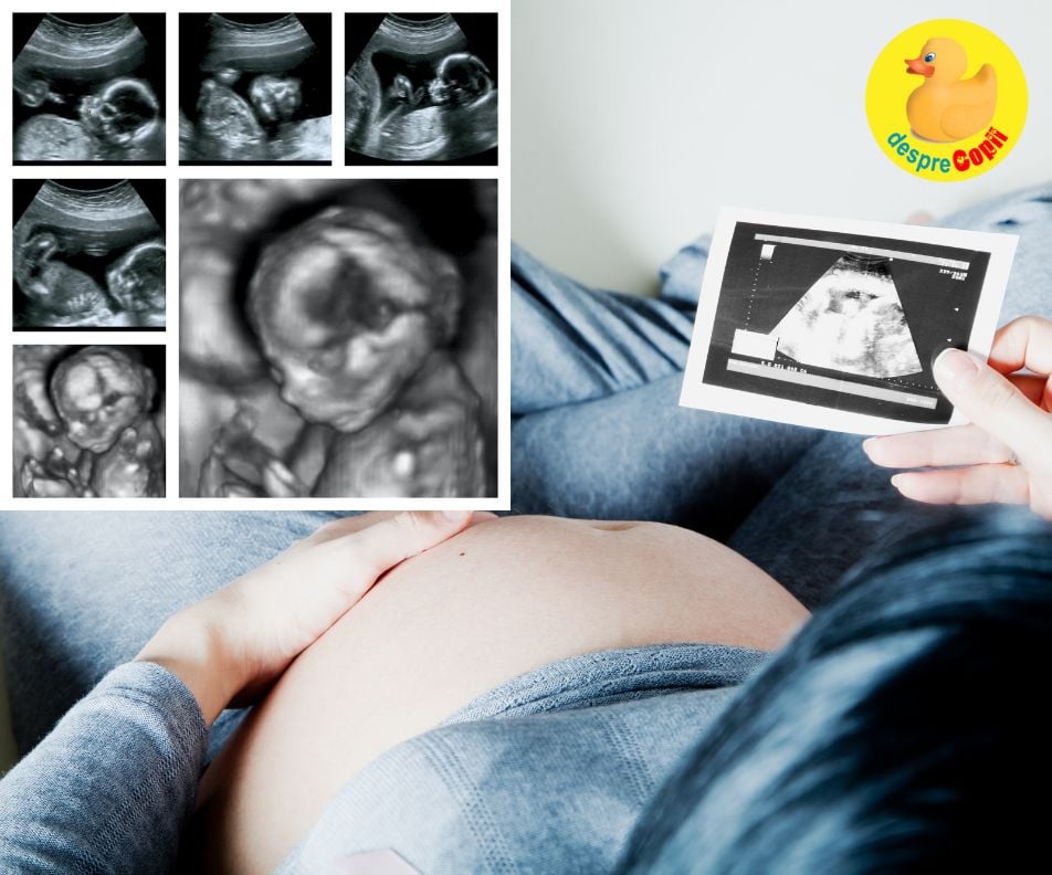 Ecografiile 3D si 4D in timpul sarcinii -  ce sunt si care este rolul lor
