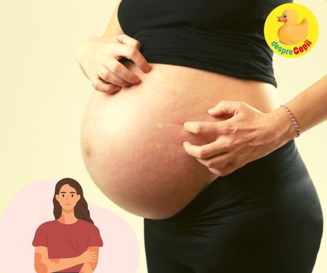Eczema in timpul sarcinii -  ce e bine de stiut