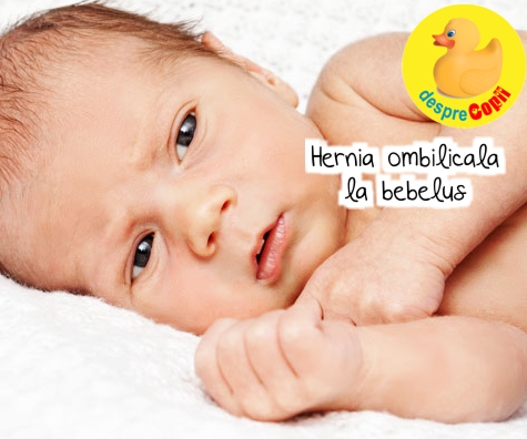 Hernia ombilicala la bebelus -  simptome si tratament