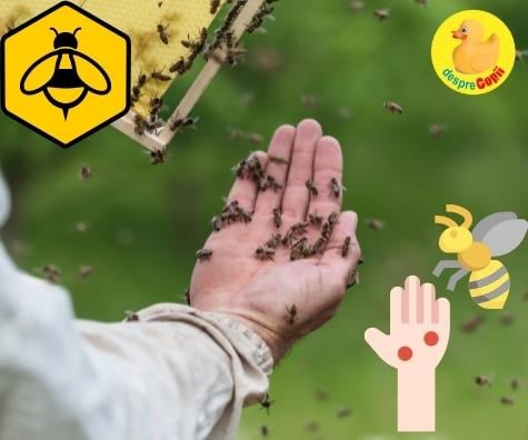 Intepatura de albina sau viespe -  iata ce e de facut si ce riscuri sunt