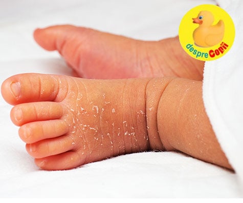 Leziuni cutanate comune la nou-nascuti -  despre pielea bebelusilor - sfatul medicului