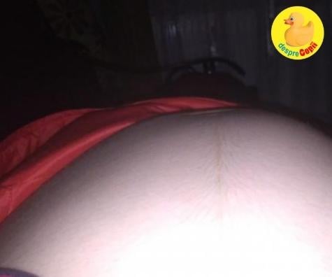 Nasterea la Brasov -  o cezariana la 39 saptamani, cu bebe avand circulara abdominala - la maternitatea Brasov