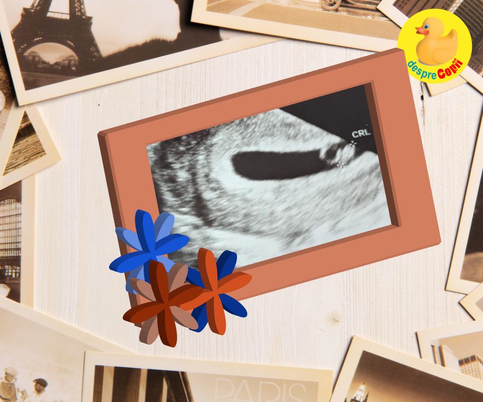 Saptamana 7 -  prima incercare si prima reusita de a ramane insarcinata - jurnal de sarcina