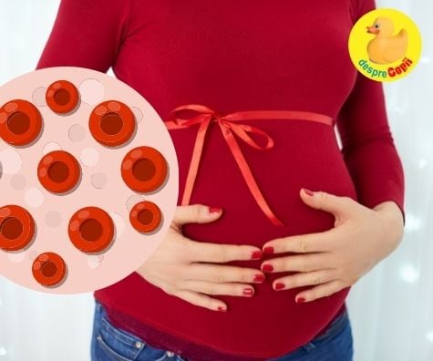 Anemia in sarcina -  simptome si ce e de facut - sfatul medicului