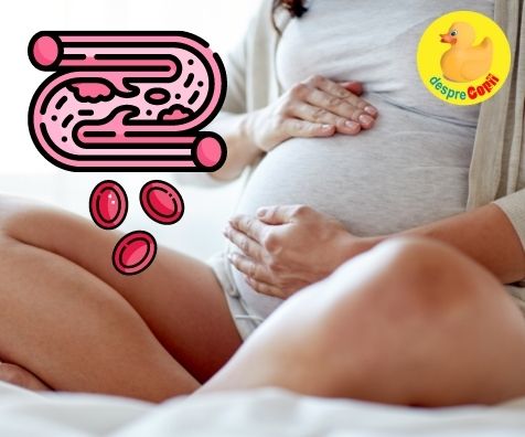 Trombofilia în timpul sarcinii -  o complicatie a sarcinii. Situatii riscante si tratament - sfatul medicului