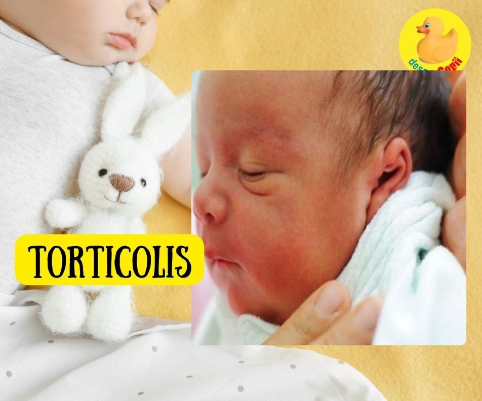 Torticolisul la bebelusi -  Tipuri si tratament - sfatul medicului