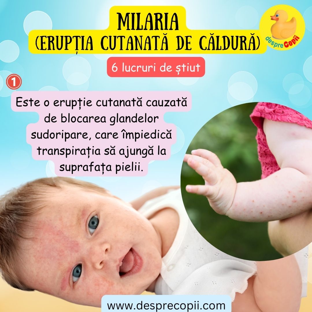milaria bebelusi 1