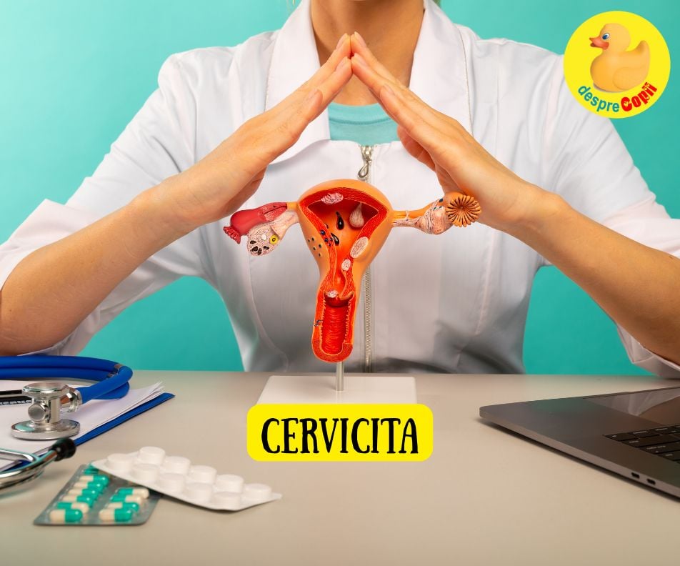 Cervicita: Ce este, cauze, simptome si tratament