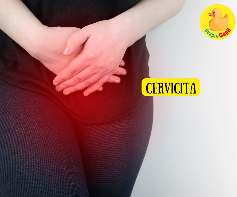 Cervicita: Infectia tacuta care iti poate afecta sanatatea – Simptome, riscuri și tratament