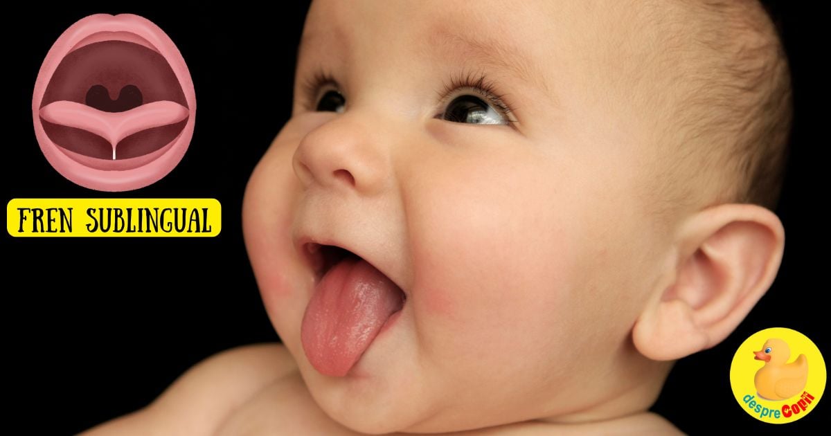 Frenul sublingual sau ankyloglossia: Cauze, simptome si tratament pentru bebelusi