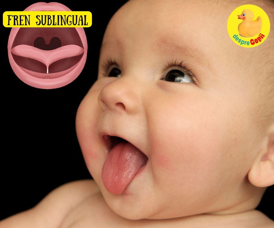 Frenul sublingual sau ankyloglossia: Cauze, simptome si tratament pentru bebelusi