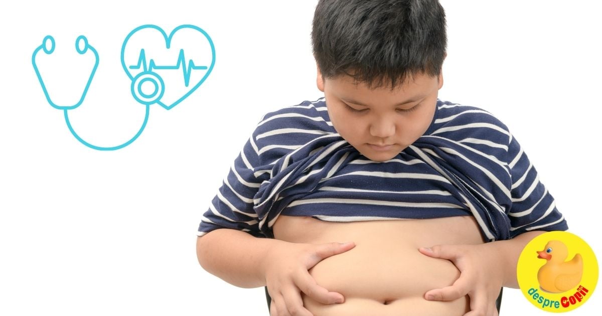 Obezitatea la copil -  diagnostic, cauze, efecte si tratament