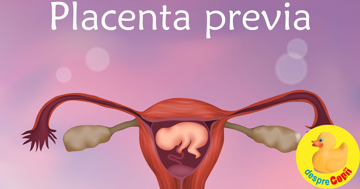 Placenta Previa -  simptome si factori de risc - sfatul medicului ginecolog