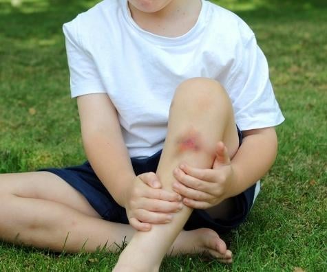 Vanataie versus hematom cutanat in cazul copiilor -…