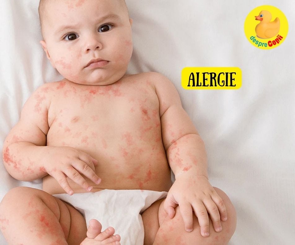 Ce alimente pot produce alergie bebelușului? Iată cum poți să le depistezi.