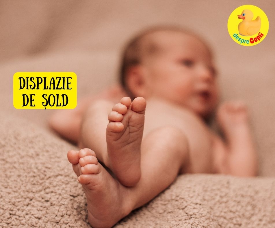 Displazia de sold la bebelusi - cauze, diagnostic si tratament - sfatul medicului