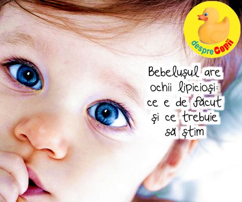 Bebelușul are ochii lipiciosi: ce e de făcut și ce trebuie să știm