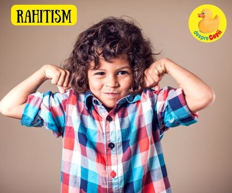 Rahitismul la copil -  cand apare si cum se trateaza - sfatul medicului pediatru
